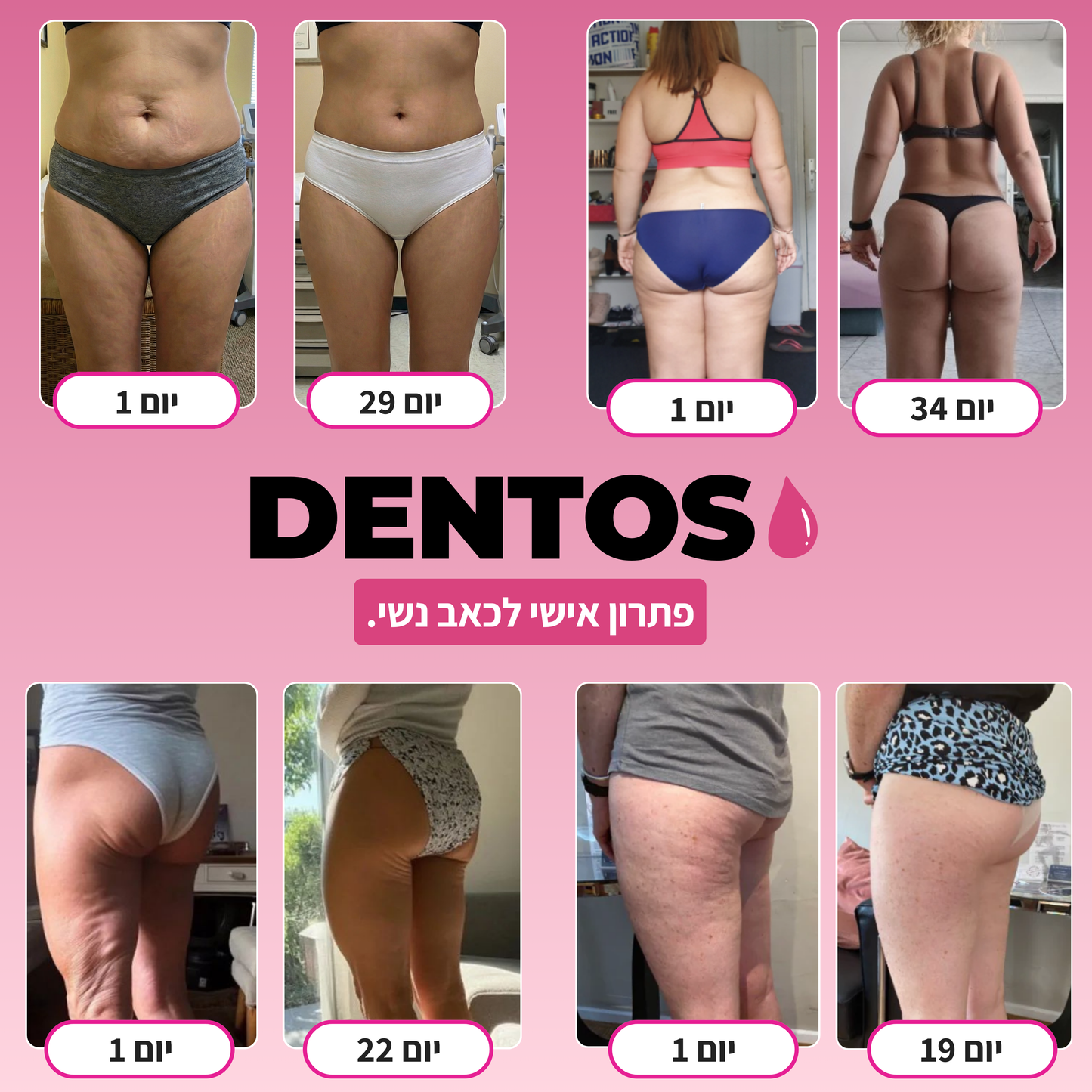 המארז הביתי להפחתת הצלוליט