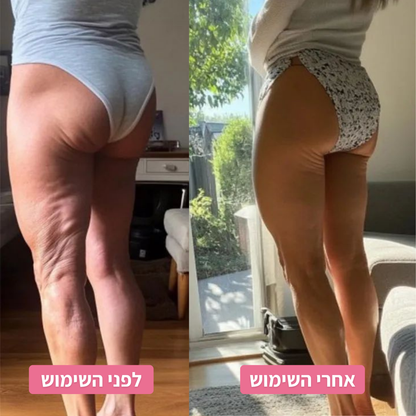המארז הביתי להפחתת הצלוליט